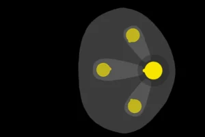 Multi Voice Focus Diagram